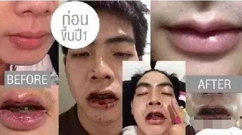 整容男网红吃瓜事件图片,揭秘网络红人背后的真相 第2张 整容男网红吃瓜事件图片,揭秘网络红人背后的真相 第2张