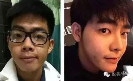 整容男网红吃瓜事件图片,揭秘网络红人背后的真相 第3张 整容男网红吃瓜事件图片,揭秘网络红人背后的真相 第3张